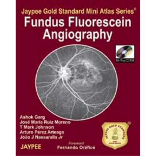 FUNDUS FLUORESCEIN ANGIOGRAPHY JAYPEE GOLD ST...