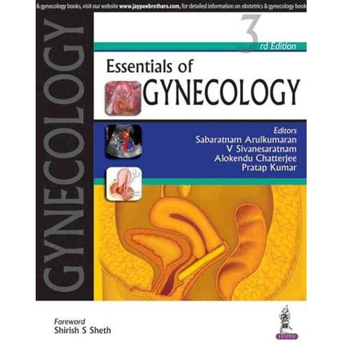 ESSENTIALS OF GYNECOLOGY