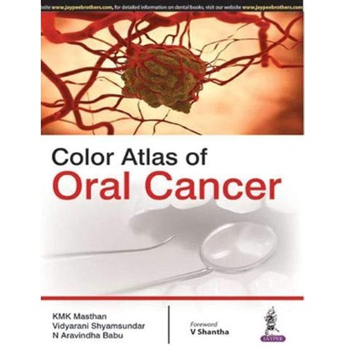 COLOR ATLAS OF ORAL CANCER