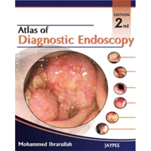 ATLAS OF DIAGNOSTIC ENDOSCOPY