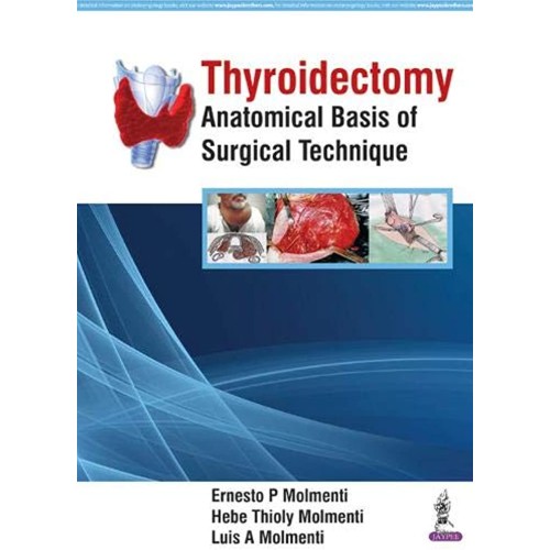 THYROIDECTOMY ANATOMICAL BASIS OF SURGICAL TE...