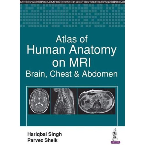 ATLAS OF HUMAN ANATOMY ON MRI:BRAIN, CHEST & ...