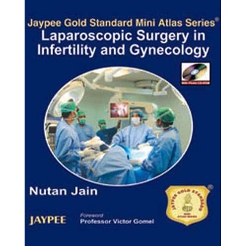 LAPAROSCOPIC SURGERY IN INFERTILITY AND GYNEC...