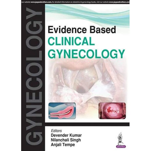 EVIDENCE BASED CLINICAL GYNECOLOGY