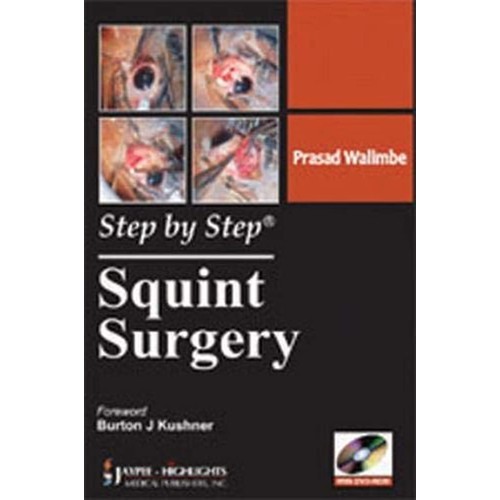 STEP BY STEP SQUINT SURGERY