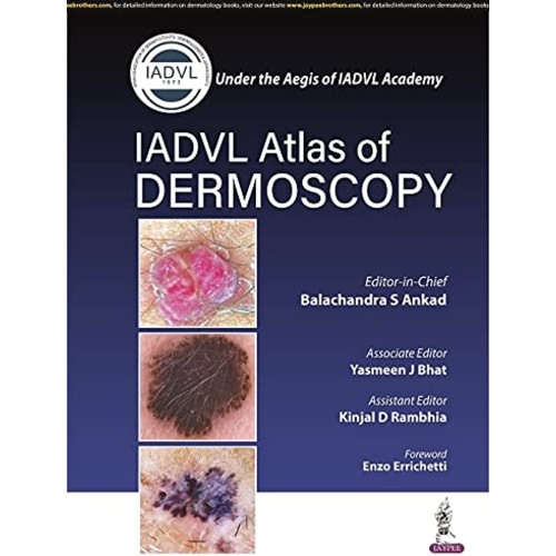 IADVL ATLAS OF DERMOSCOPY