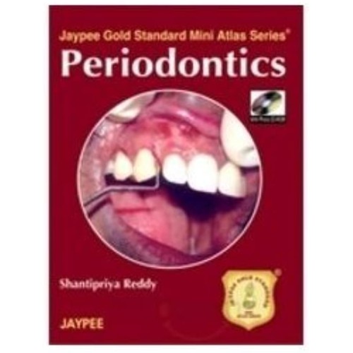 PERIODONTICS JAYPEE GOLD STANDARD MINI ATLAS ...