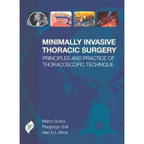 MINIMALLY INVASIVE THORACIC SURGERY PRINCIPLES AND PRACTICE OF THORACOSCOPIC TECHNIQUE