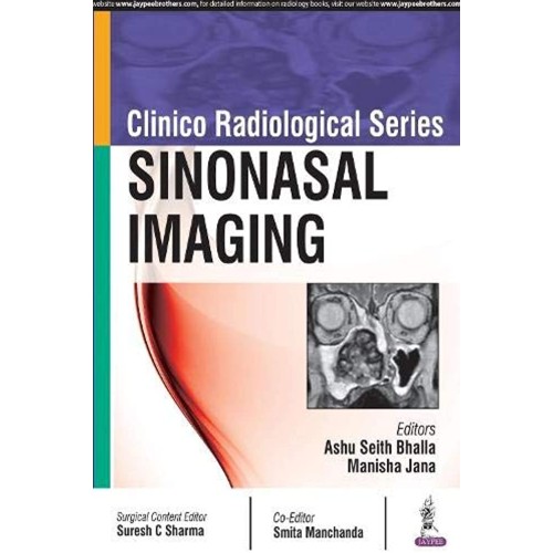 CLINICO RADIOLOICAL SERIES:SINONASAL IMAGING