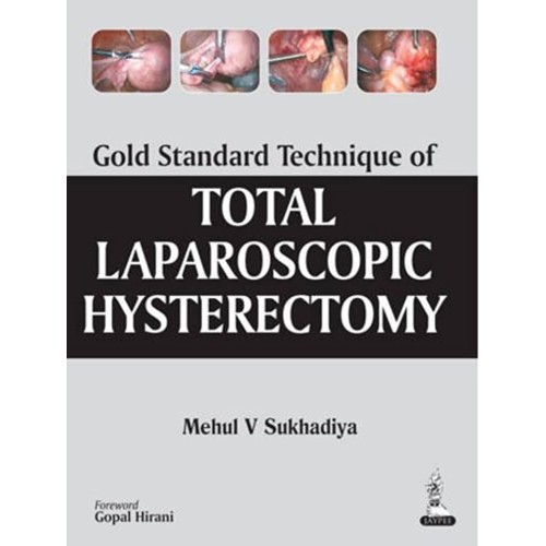 GOLD STANDARD TECHNIQUE OF TOTAL LAPAROSCOPIC...