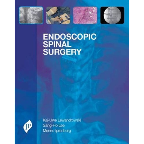 ENDOSCOPIC SPINAL SURGERY