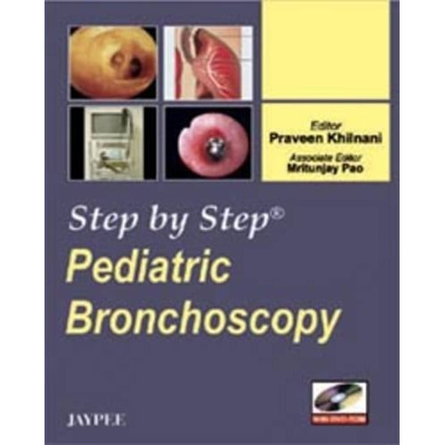 STEP BY STEP PEDIATRIC BRONCHOSCOPY WITH DVD-...