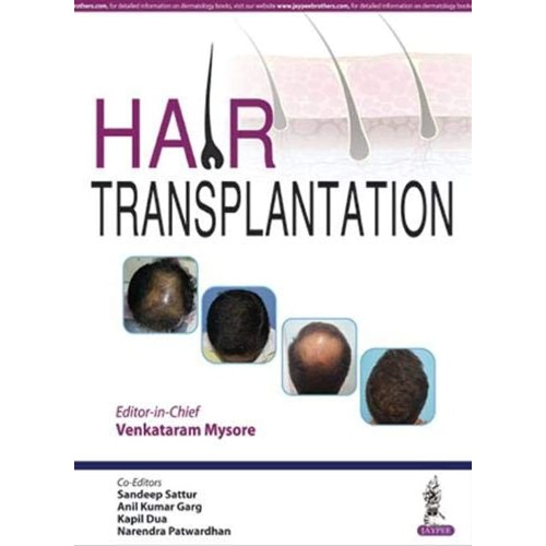 HAIR TRANSPLANTATION