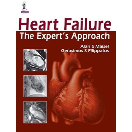 HEART FAILURE THE EXPERT'S APPROACH