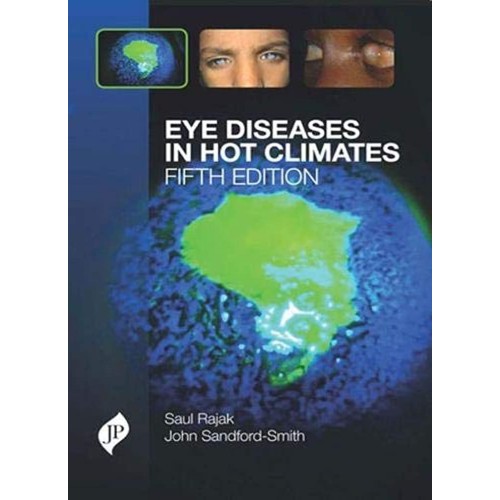 EYE DISEASES IN HOT CLIMATES