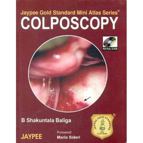 COLPOSCOPY JAYPEE GOLD STANDARD MINI ATLAS SE...