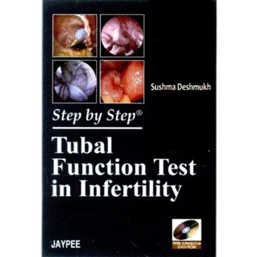 STEP BY STEP TUBAL FUNCTION TEST IN INFERTILI...