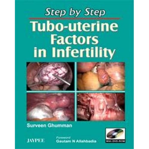 STEP BY STEP TUBO-UTERINE FACTORS IN INFERTIL...