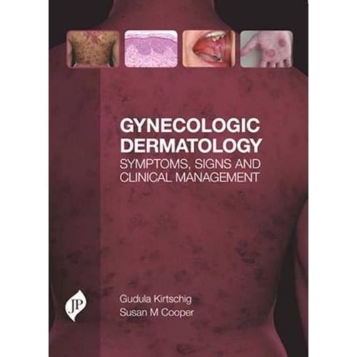 GYNECOLOGIC DERMATOLOGY SYMPTOMS, SIGNS AND CLINICAL MANAGEMENT