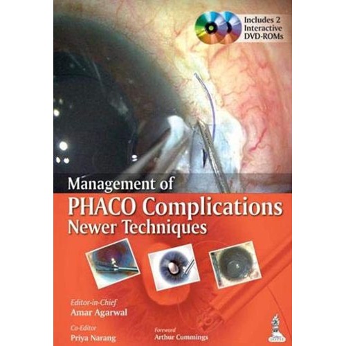 MANAGEMENT OF PHACO COMPLICATIONS NEWER TECHNIQUES INCLUDES 2 INT.DVD-ROM