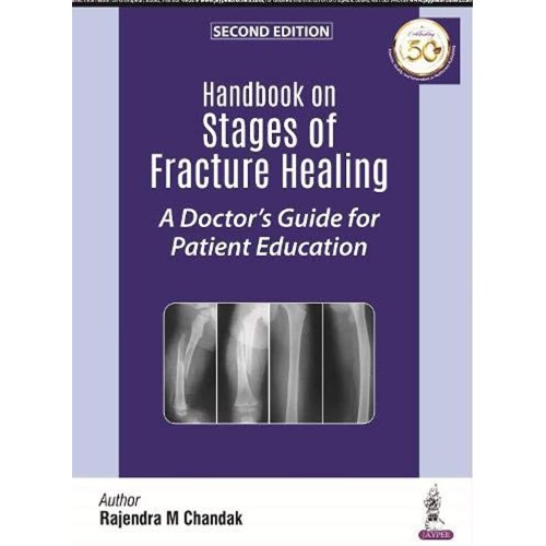 HANDBOOK ON STAGES OF FRACTURE HEALING A DOCTOR'S GUIDE FOR PATIENT EDUCATION