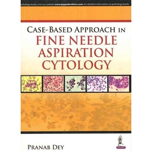 CASE-BASED APPROACH IN FINE NEEDLE ASPIRATION CYTOLOGY