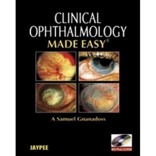 OPHTHALMOLOGY MADE EASY WITH PHOTO CD-ROM