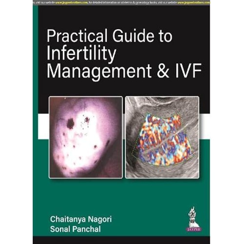 PRACTICAL GUIDE TO INFERTILITY MANAGEMENT & I...