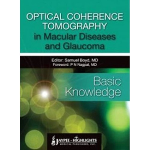 OPTICAL COHERENCE TOMOGRAPHY IN MACULAR DISEA...