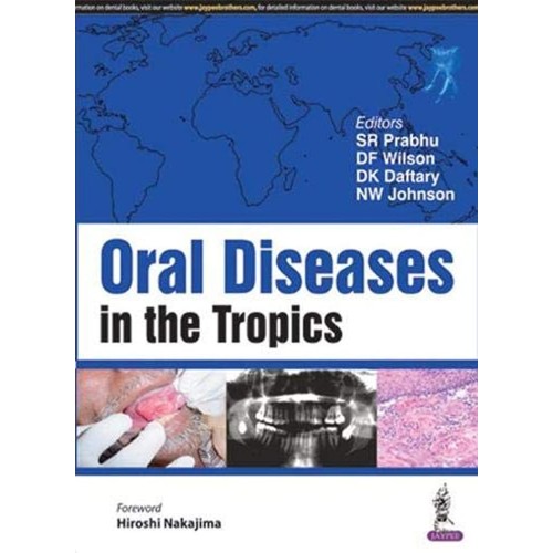 ORAL DISEASES IN THE TROPICS