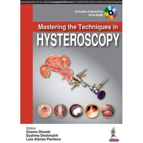 MASTERING THE TECHNIQUES IN HYSTEROSCOPY WITH DVD-ROM