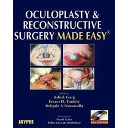 OCULOPLASTY & RECONSTRUCTIVE SURGERY MADE EAS...