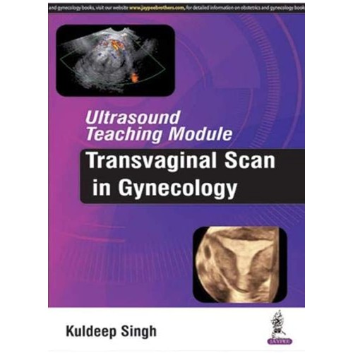 ULTRASOUND TEACHING MODULE:TRANSVAGINAL SCAN ...