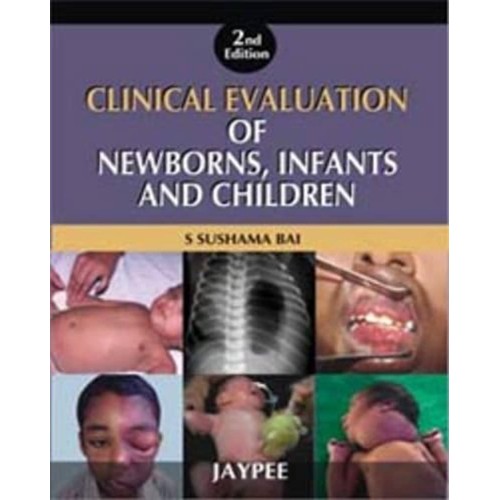 CLINICAL EVALUATION OF NEWBORNS, INFANTS AND ...