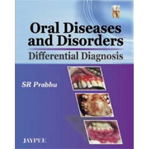 ORAL DISEASES AND DISORDERS DIFFERENTIAL DIAG...