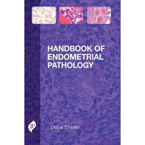 HANDBOOK OF ENDOMETRIAL PATHOLOGY