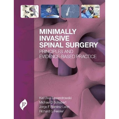 MINIMALLY INVASIVE SPINAL SURGERY PRINCIPLES AND EVIDENCE-BASED PRACTICE