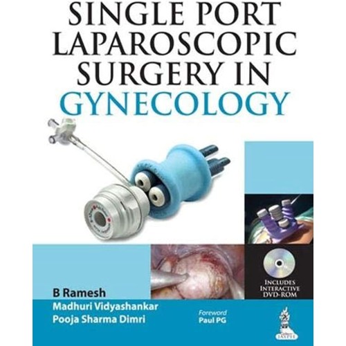 SINGLE PORT LAPAROSCOPIC SURGERY IN GYNECOLOG...