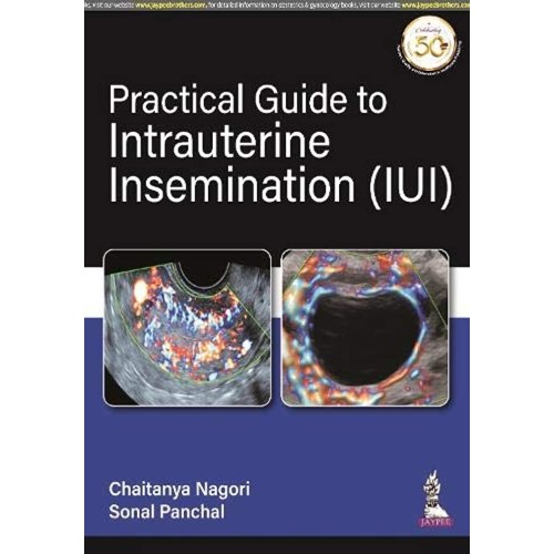 PRACTICAL GUIDE TO INTRAUTERINE INSEMINATION ...