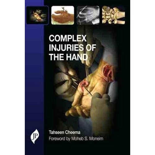 COMPLEX INJURIES OF THE HAND