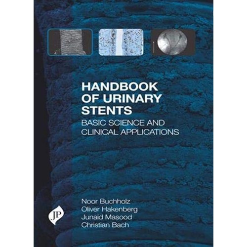 HANDBOOK OF URINARY STENTS BASIC SCIENCE AND CLINICAL APPLICATIONS