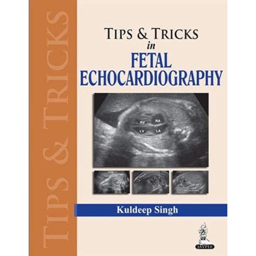 TIPS & TRICS IN FETAL ECHOCARDIOGRAPHY