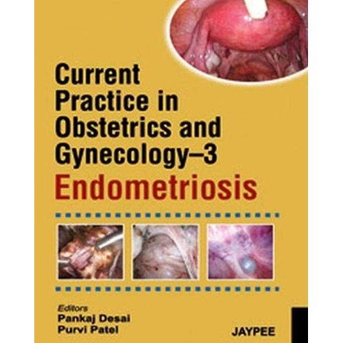 CURRENT PRACTICE IN OBSTETRICS AND GYNECOLOGY-3 ENDOMETRIOSIS