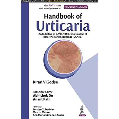 HANDBOOK OF URTICARIA