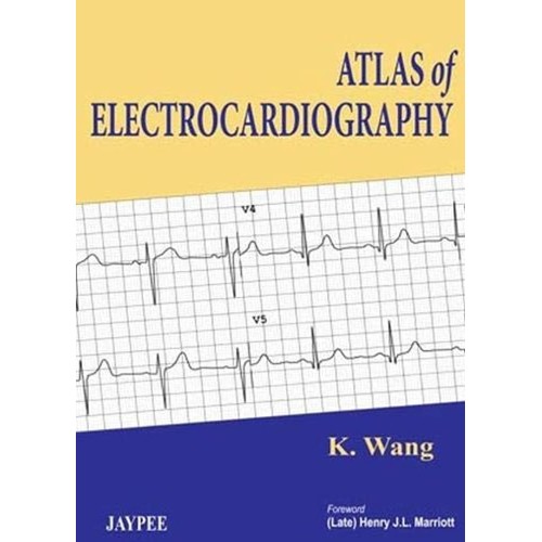 ATLAS OF ELECTROCARDIOGRAPHY