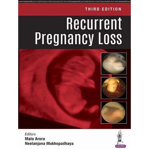 RECURRENT PREGNANCY LOSS