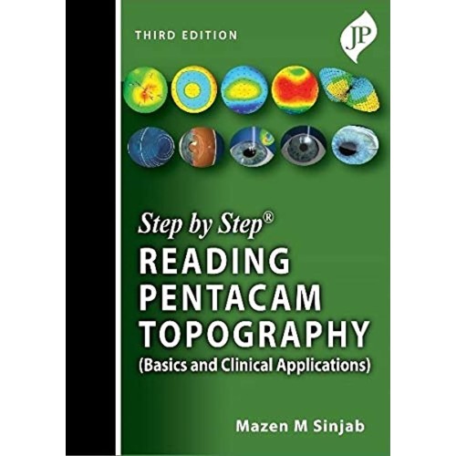 STEP BY STEP READING PENTACAM TOPOGRAPHY (BAS...