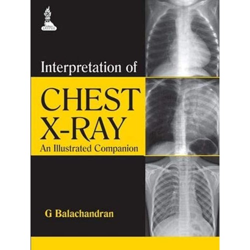 INTERPRETATION OF CHEST X-RAY AN ILLUSTRATED COMPANION