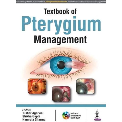 TEXTBOOK OF PTERYGIUM MANAGEMENT WITH DVD-ROM