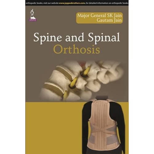 SPINE AND SPINAL ORTHOSES